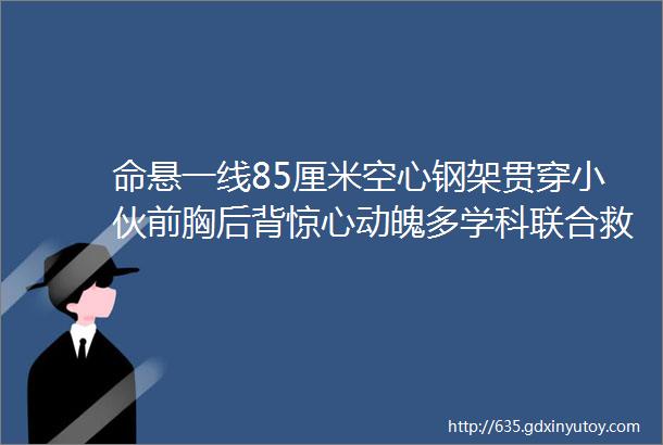 命悬一线85厘米空心钢架贯穿小伙前胸后背惊心动魄多学科联合救治转危为安